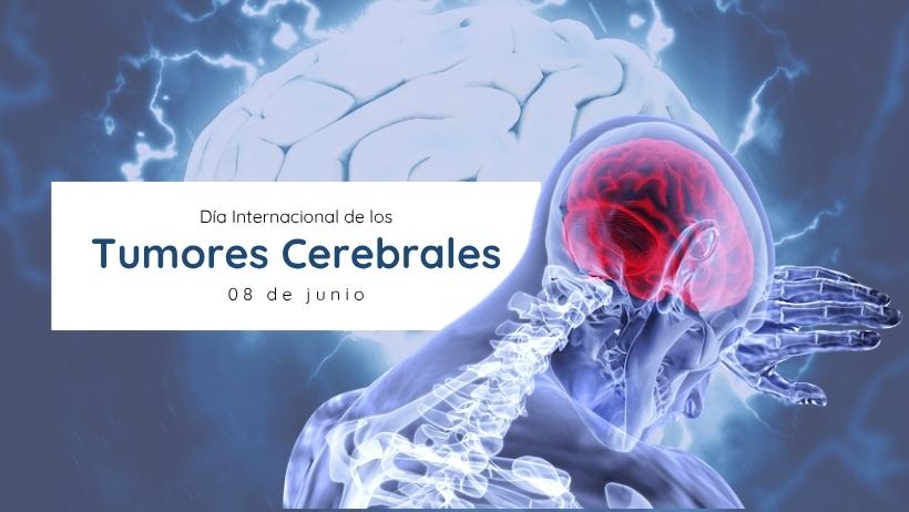 Día Internacional de los Tumores Cerebrales