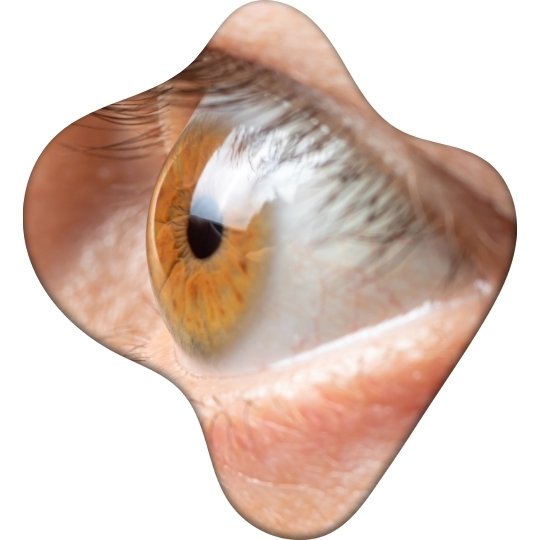 12 de marzo Dia Mundial del Glaucoma Vista Revista Marketing