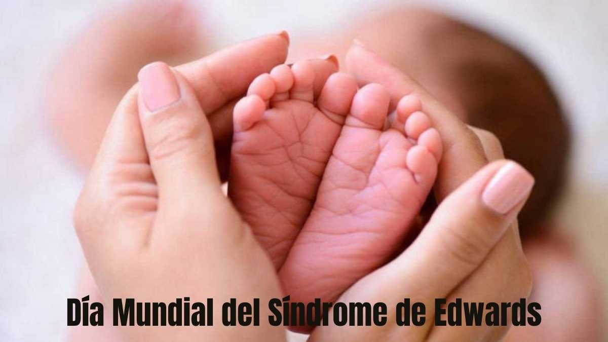 Día Mundial del Síndrome de Edwards o Trisomía 18
