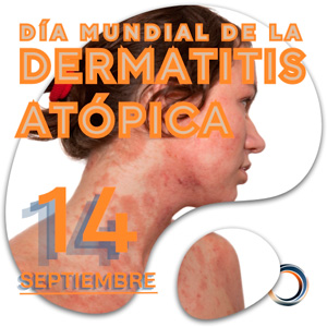 14 de septiembre Dia Mundial de la Dermatitis Atopica