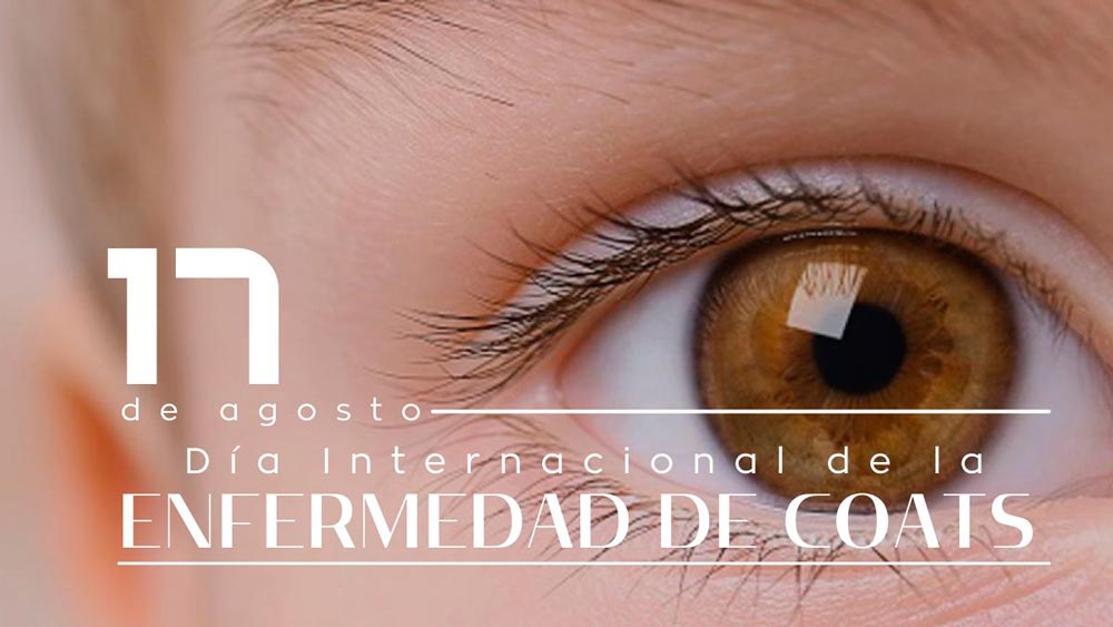 17 de agosto D&iacute;a Internacional de la Enfermedad de Coats