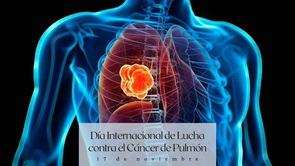 D&iacute;a Internacional de la Lucha Contra el C&aacute;ncer de Pulm&oacute;n 17 de noviembre