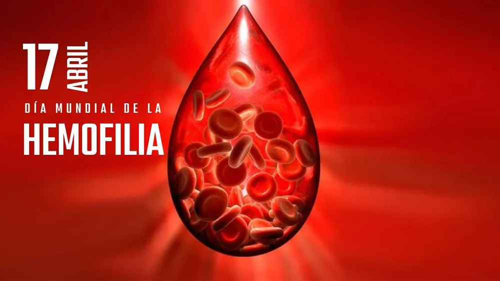 17 de abril D&iacute;a Mundial de la Hemofilia